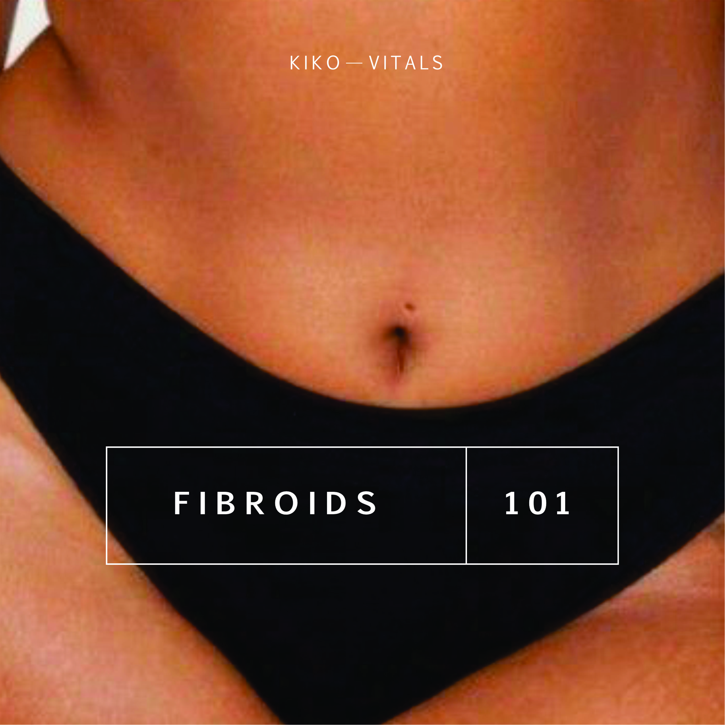 Fibroids 101 : A Comprehensive Guide to Understanding, Diagnosing, and Managing Uterine Fibroids